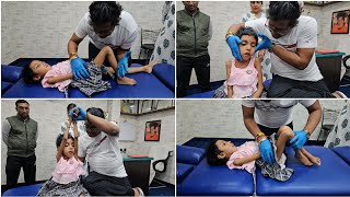 Chiropractic treatment for CP child [upl. by Anazraf981]