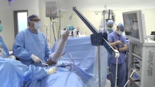 Shoulder Arthroscopy Surgery [upl. by Dorahs]