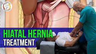 Hiatal Hernia Treatment  Synergy Wellness Chiropractic amp Physical Therapy PLLC [upl. by Xirtaeb]