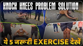 SSC GD Medical Knock Knees Problem Soution Exercises How to Cure Knock Knees  rojgarwithankit rwa [upl. by Lumbye]