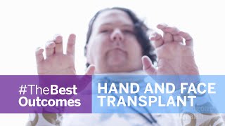 Face and Double Hand Transplant Journey Joe Dimeos Story [upl. by Sundberg]