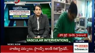 Laser Treatment for Varicose Veins  Health File  TV5 News [upl. by Anaynek]