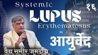 86 SLE  SYSTEMIC LUPUS ERYTHEMATOUS In AYURVEDA  PART 16  VDSAMEER JAMADGNI SIR [upl. by Leaper]