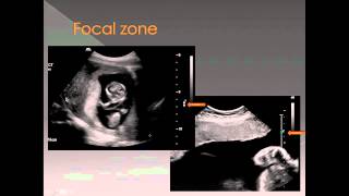 Ultrasound 6  Knobology 2  Focus Field of View Frame Rate [upl. by Carnes837]