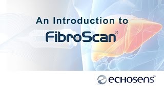 A Patients Introduction to FibroScan [upl. by Inverson]