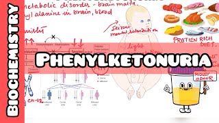 Phenylketonuria explained for USMLE NEET PG NCLEX [upl. by Llessur]