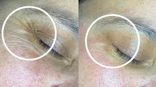 3 Effective techniques for WRINKLES around the EYES [upl. by Alial273]