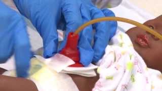 Caring for My Child with a Gastrostomy Tube  St Louis Childrens Hospital [upl. by Pisarik]