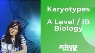 Karyotypes  A Level amp IB Biology [upl. by Johann977]