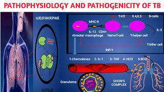 Pathophysiology pathogenicity of Mycobacterium tuberculosis II Primary and secondary TB Part2 [upl. by Lin984]