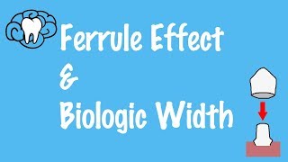 Ferrule Effect and Biologic Width [upl. by Yecnay]