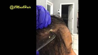 Part 4 Dermal Cleanse Scalp Scratching Flakes Removed 1 [upl. by Eanram789]