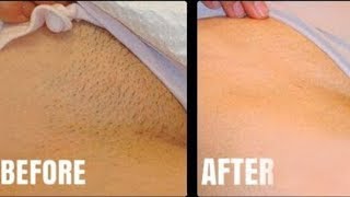 Use This amp Get Rid of Razor Bumps  Bye To After Shave Bumps [upl. by Eivod310]