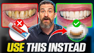 Neuroscientist quotToothpaste Is Damaging Your Teethquot How To Take Care of Your Teeth [upl. by Maida]