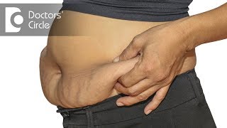 How to prevent sagging of skin after weight loss  Dr Nanda Rajaneesh [upl. by Anewor583]