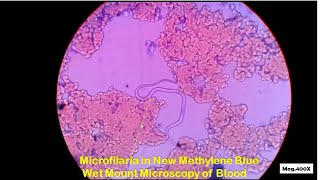 Microfilaria in blood Microscopy [upl. by Charmane22]