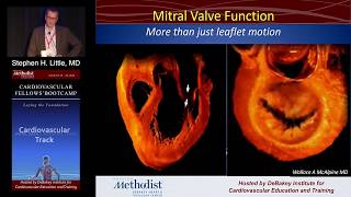 Mitral Stenosis Stephen H Little MD Sunday August 21 2016 [upl. by Enomrej]