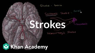 Strokes  Miscellaneous  Heatlh amp Medicine  Khan Academy [upl. by Blinnie]