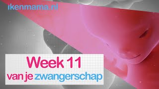 11 weken zwanger  ikenmamanl [upl. by Zachariah]