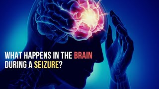 What happens in Brain during Seizure Neurobiology [upl. by Roze214]