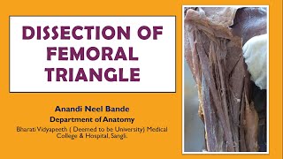 Femoral Triangle  Dissection Anatomy  Boundaries and Contents Femoral Sheath Femoral Canal [upl. by Rod]