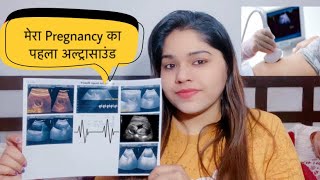 My First Pregnancy 🤰 Ultrasound  6 Weeks Pregnancy Scan  Baby Heartbeat Scan [upl. by Juta]