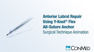 Anterior Labral Repair Using the YKnot® Flex  CONMED Animation [upl. by Stutman]