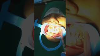 Periapical Surgery [upl. by Hilaria361]