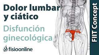 Disfunciones ginecológicas y dolor de espalda lumbar y ciático  Causas y tratamiento [upl. by Leirda]