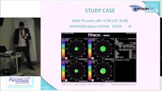 Dr Frédéric HEHN  Les résultats du traitement de la prebytie en Isovision [upl. by Madge]
