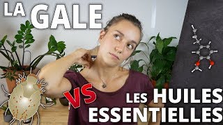 LA GALE  Remède naturel aux huiles essentielles [upl. by Cicero459]