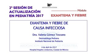 Exantema y fiebre de causa infecciosa [upl. by Ehcsrop274]