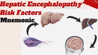 Hepatic Encephalopathy Risk factors Mnemonic [upl. by Ahsitruc]