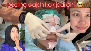 Peeling wajah di klinik lagi [upl. by Ahsasal586]