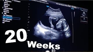 💖20 WEEKS Pregnant Ultrasound  BABY SUCKING HIS THUMB💖 [upl. by Nelan]