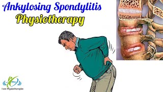 How to treat Ankylosing Spondylitis  Symptom Diagnosis Physiotherapy  Physical Therapy exercises [upl. by Bell]