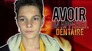 AVOIR UN APPAREIL DENTAIRE 2 [upl. by Dorothea]