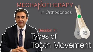 Mechanotherapy in Orthodontics Types of Tooth Movement Pt 1 [upl. by Svensen]