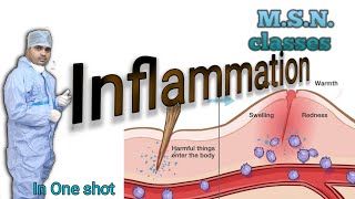 MSNwhat is InflammationMedical surgical nursingpathophysiology of inflammationsteps [upl. by Rind]