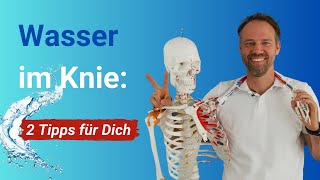 Warum schwillt mein Knie an ➡️ 2 konkrete Tipps gegen Wasser im ArthroseKnie [upl. by Noryk]