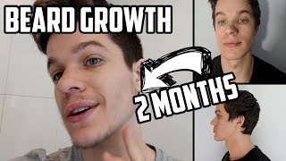 Beard Growth Progress Minoxidil 2 Months [upl. by Claresta]