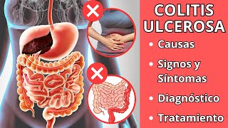 COLITIS ULCEROSA  Causas signos y síntomas diagnóstico y tratamiento [upl. by Ynner170]