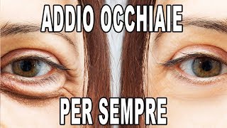 Come ELIMINARE le OCCHIAIE Per Sempre [upl. by Kalindi]