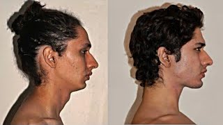 Top 3 Jawline Exercises  Jawline Exercise  Jawline Mewing [upl. by Eissahc]