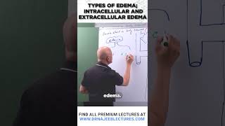 Types of edema Intracellular and extracellular edema [upl. by Femi]