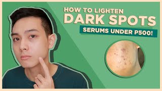 How to Remove Dark Spots and Get Clear Skin Pigmentation Dark Underarms Acne scars amp more [upl. by Blake]