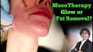 MesoTherapy How to Get Beautiful Skin [upl. by Mort]