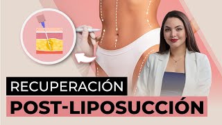 Liposucción Claves para EVITAR la FIBROSIS y prolongar los resultados [upl. by Mikal315]