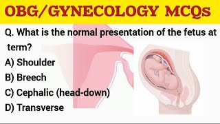 OBG GYNECOLOGY MCQs rrbnursingofficerexam aiimsnorcetmcq [upl. by Siuoleoj]