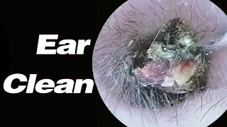 Ear Picking ASMR Its Hard As A Rock And Its Super Comfortable To Clean [upl. by Cramer]